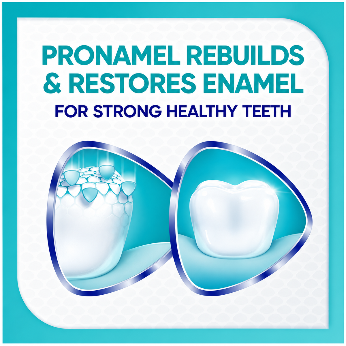 Sensodyne Pronamel Advanced Whitening Toothpaste, 6.5 oz, 4-Pack
